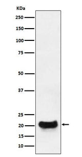 Anti-DCTN5 Rabbit Monoclonal Antibody Boster Bio