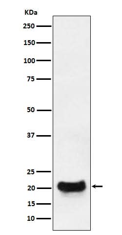 Anti-DCTN5 Rabbit Monoclonal Antibody Boster Bio