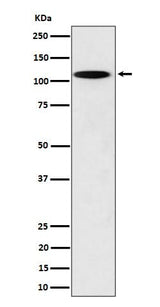 Anti-N4BP1 Rabbit Monoclonal Antibody Boster Bio