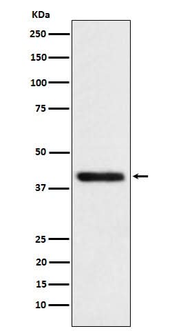 Anti-TMOD2 Rabbit Monoclonal Antibody Boster Bio