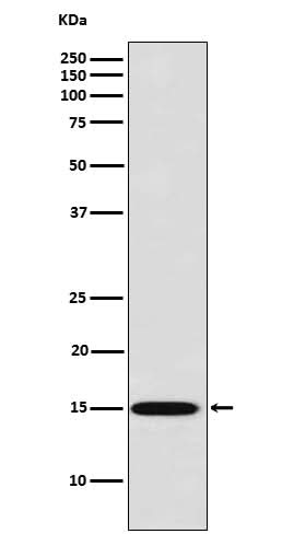 Anti-Galectin 7 Rabbit Monoclonal Antibody Boster Bio