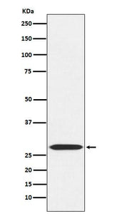 Anti-MRPL28 Rabbit Monoclonal Antibody Boster Bio