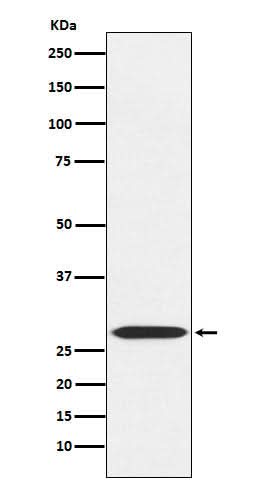 Anti-MRPL28 Rabbit Monoclonal Antibody Boster Bio