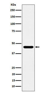 Anti-ACTR1B Rabbit Monoclonal Antibody Boster Bio