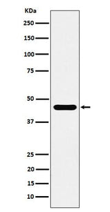 Anti-ACTR1B Rabbit Monoclonal Antibody Boster Bio