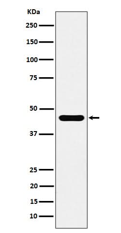 Anti-ACTR1B Rabbit Monoclonal Antibody Boster Bio