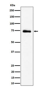 Anti-RAVER2 Rabbit Monoclonal Antibody Boster Bio