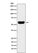 Anti-Salivary alpha amylase Rabbit Monoclonal Antibody Boster Bio