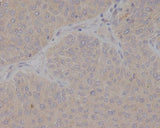 Anti-GCET2 Monoclonal Antibody Boster Bio
