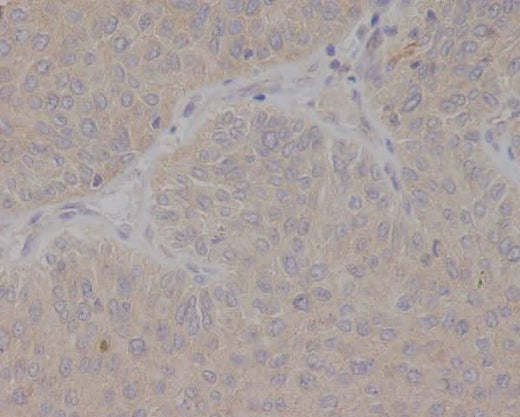 Anti-GCET2 Monoclonal Antibody Boster Bio
