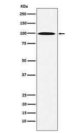 Anti-AP1G1 Rabbit Monoclonal Antibody Boster Bio