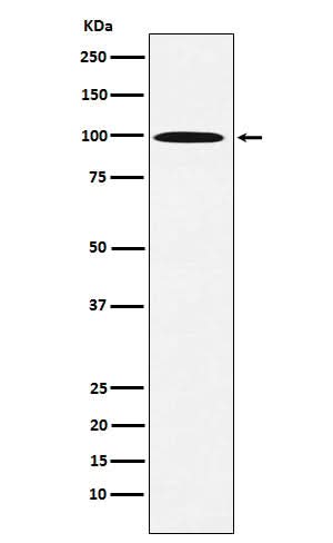 Anti-AP1G1 Rabbit Monoclonal Antibody Boster Bio