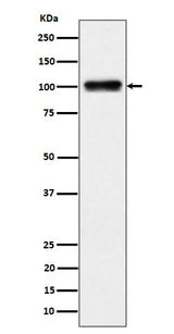 Anti-Nesprin3 Rabbit Monoclonal Antibody Boster Bio