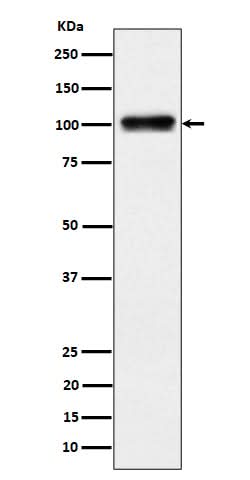 Anti-Nesprin3 Rabbit Monoclonal Antibody Boster Bio