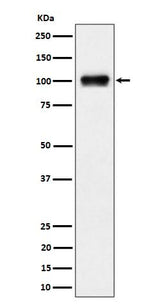 Anti-Nesprin3 Rabbit Monoclonal Antibody Boster Bio