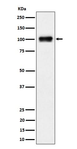 Anti-Nesprin3 Rabbit Monoclonal Antibody Boster Bio
