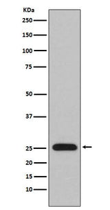 Anti-Lambda Light chain IGLV1-51 Monoclonal Antibody Boster Bio