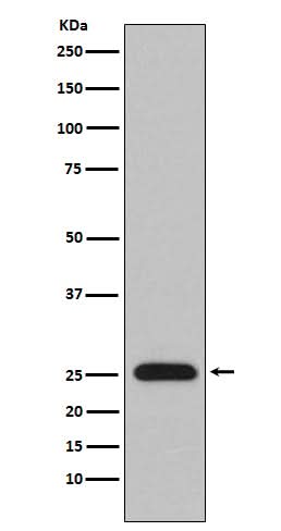 Anti-Lambda Light chain IGLV1-51 Monoclonal Antibody Boster Bio