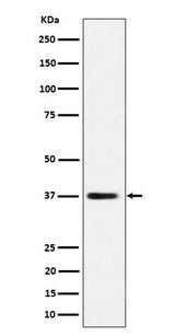 Anti-MRPS31 Rabbit Monoclonal Antibody Boster Bio