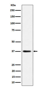Anti-MRPS31 Rabbit Monoclonal Antibody Boster Bio