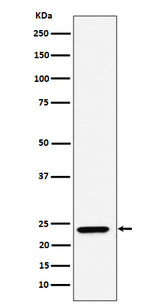 Anti-DNAJC12 Rabbit Monoclonal Antibody Boster Bio