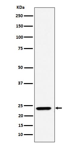 Anti-DNAJC12 Rabbit Monoclonal Antibody Boster Bio