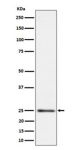 Anti-MRPS15 Rabbit Monoclonal Antibody Boster Bio