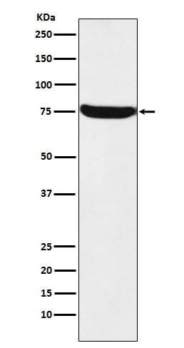 Anti-HTF9C Rabbit Monoclonal Antibody Boster Bio