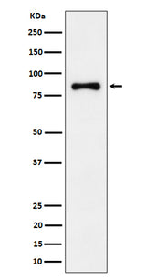 Anti-ALDH16A1 Rabbit Monoclonal Antibody Boster Bio