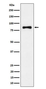 Anti-ALDH16A1 Rabbit Monoclonal Antibody Boster Bio