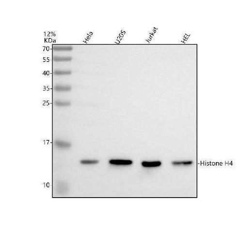Anti-Histone H4 (acetyl K16) HIST1H4A Monoclonal Antibody Boster Bio