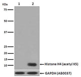 Anti-Histone H4 (acetyl K5) HIST1H4A Monoclonal Antibody Boster Bio