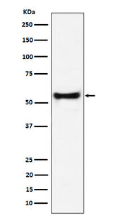 Anti-PDCD7 Rabbit Monoclonal Antibody Boster Bio