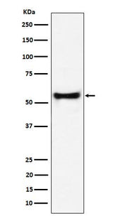 Anti-PDCD7 Rabbit Monoclonal Antibody Boster Bio