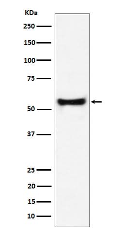Anti-PDCD7 Rabbit Monoclonal Antibody Boster Bio