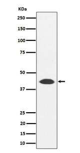 Anti-NUDT19 Rabbit Monoclonal Antibody Boster Bio