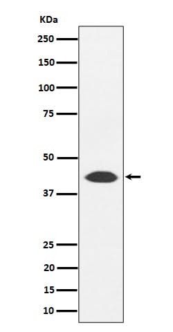 Anti-NUDT19 Rabbit Monoclonal Antibody Boster Bio
