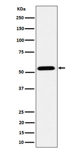 Anti-ENPP5 Rabbit Monoclonal Antibody Boster Bio