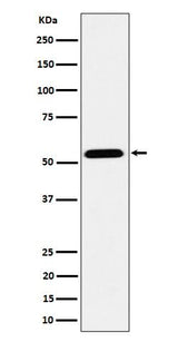 Anti-ENPP5 Rabbit Monoclonal Antibody Boster Bio