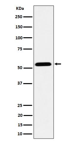 Anti-ENPP5 Rabbit Monoclonal Antibody Boster Bio