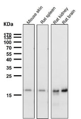 Anti-TIMM22 Rabbit Monoclonal Antibody Boster Bio