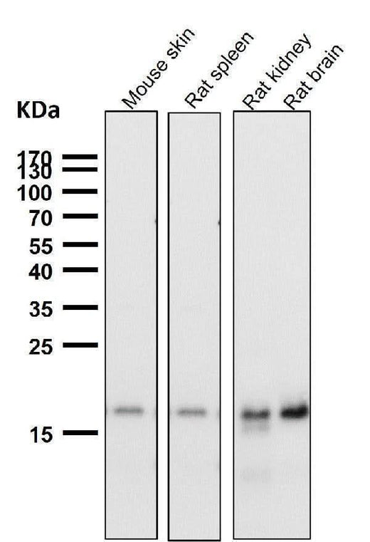 Anti-TIMM22 Rabbit Monoclonal Antibody Boster Bio
