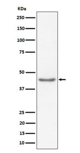 Anti-RBMXL2 Rabbit Monoclonal Antibody Boster Bio