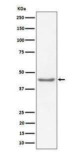 Anti-RBMXL2 Rabbit Monoclonal Antibody Boster Bio