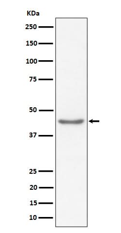 Anti-RBMXL2 Rabbit Monoclonal Antibody Boster Bio