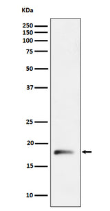 Anti-RPL26L1 Rabbit Monoclonal Antibody Boster Bio
