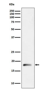 Anti-RPL26L1 Rabbit Monoclonal Antibody Boster Bio