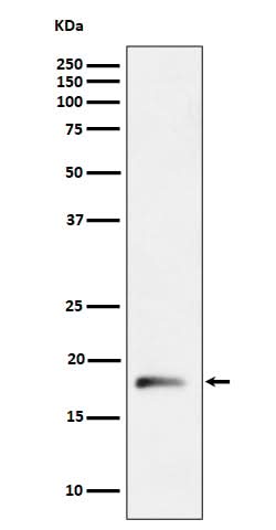 Anti-RPL26L1 Rabbit Monoclonal Antibody Boster Bio