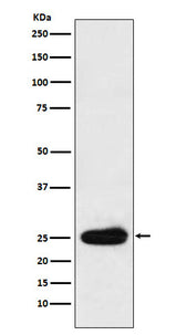 Anti-Kappa light chain Rabbit Monoclonal Antibody Boster Bio