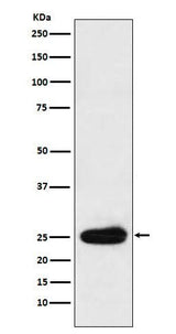 Anti-Kappa light chain Rabbit Monoclonal Antibody Boster Bio
